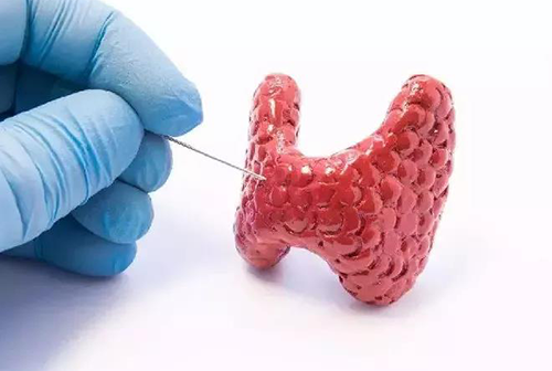 甲狀腺疾病，包括甲狀腺功能減退和甲狀腺功能亢進(jìn)，自古以來就是反復(fù)被醫(yī)學(xué)研究人員研究的疾病